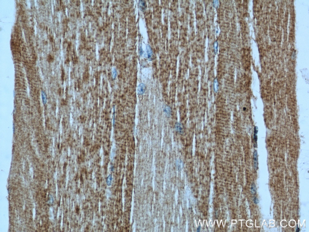 Immunohistochemistry (IHC) staining of human skeletal muscle tissue using Alpha Actin Polyclonal antibody (23082-1-AP)