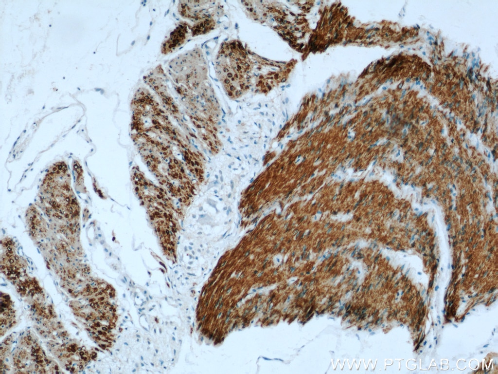 Immunohistochemistry (IHC) staining of human small intestine tissue using Alpha Actin Polyclonal antibody (23082-1-AP)