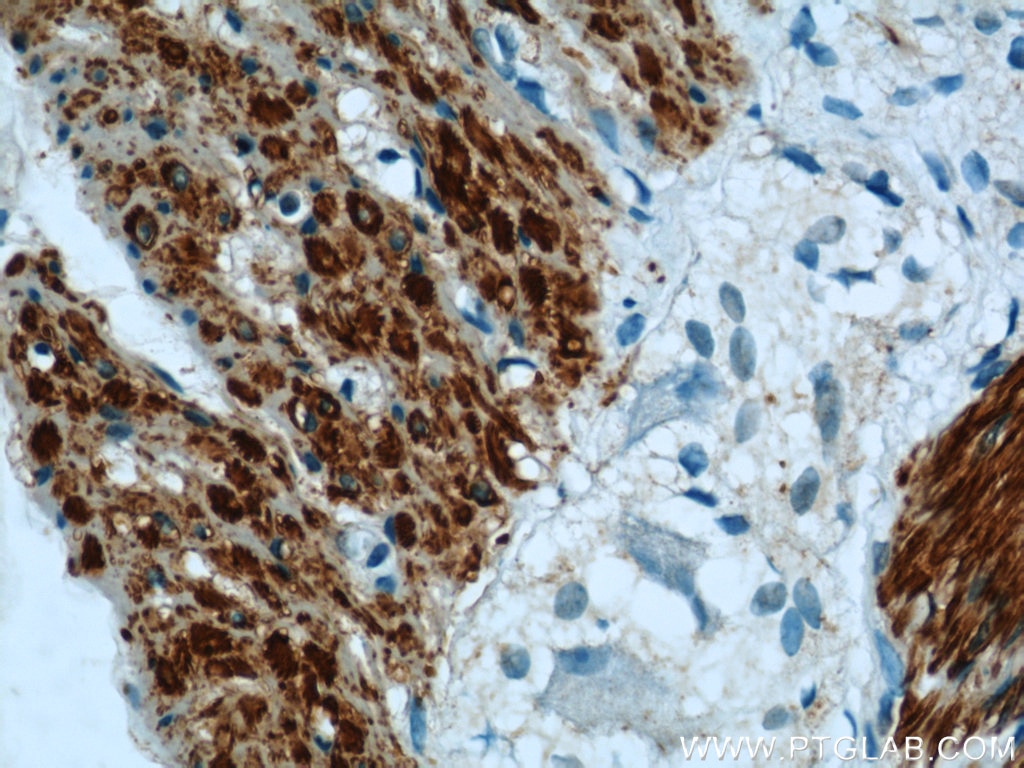 Immunohistochemistry (IHC) staining of human small intestine tissue using Alpha Actin Polyclonal antibody (23082-1-AP)