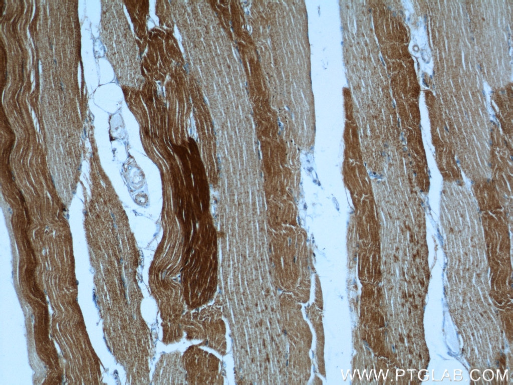 Immunohistochemistry (IHC) staining of human skeletal muscle tissue using Alpha Actin Polyclonal antibody (23082-1-AP)