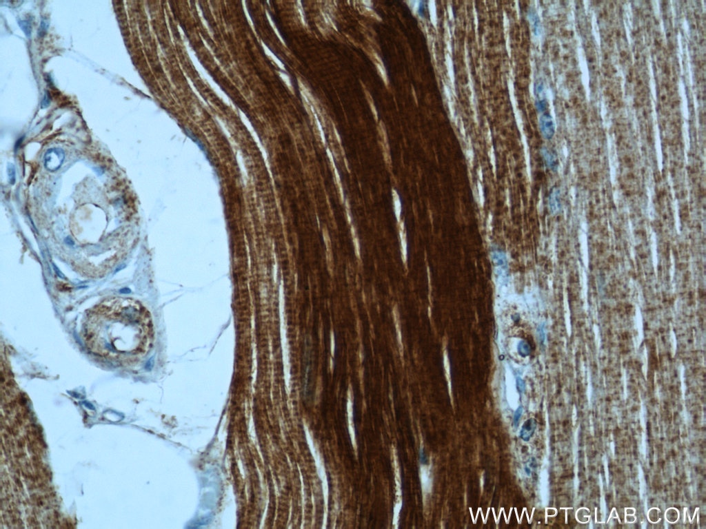 Immunohistochemistry (IHC) staining of human skeletal muscle tissue using Alpha Actin Polyclonal antibody (23082-1-AP)