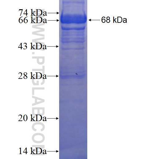 ACTC1 fusion protein Ag1471 SDS-PAGE