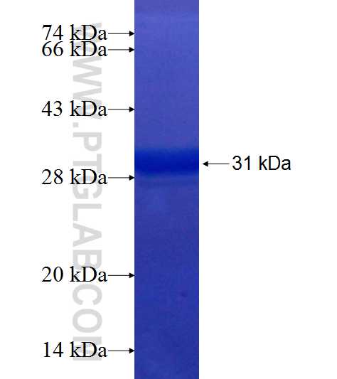 ACTC1 fusion protein Ag19482 SDS-PAGE