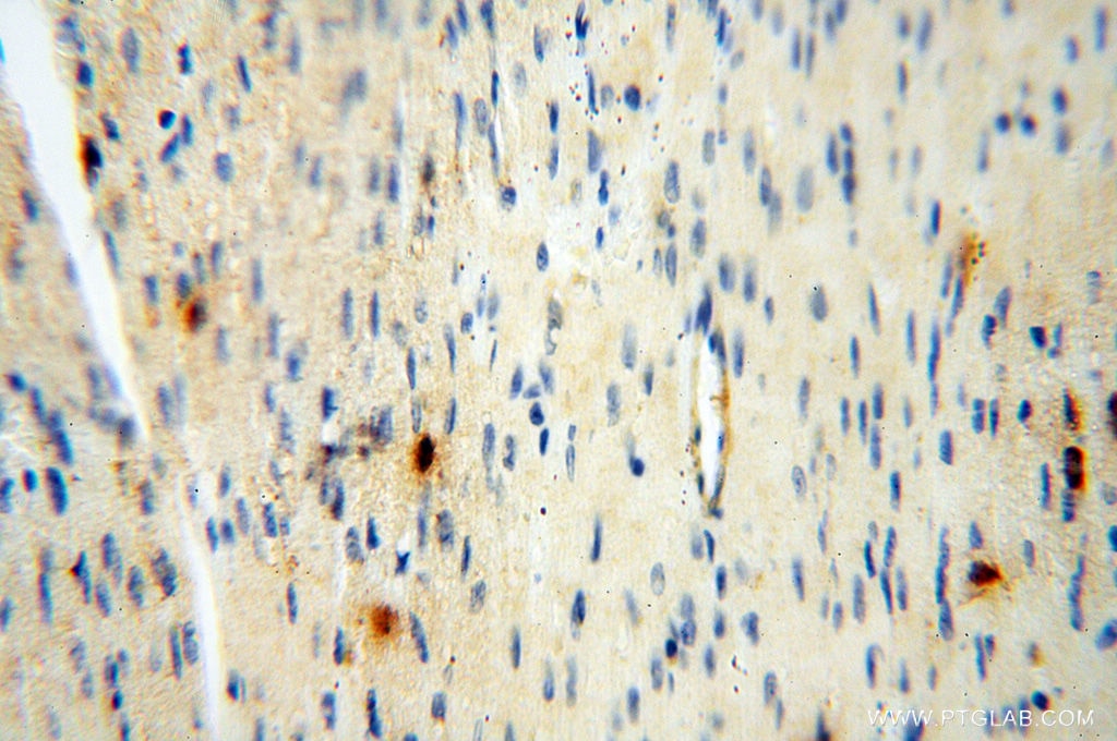 Alpha cardiac muscle actin specific
