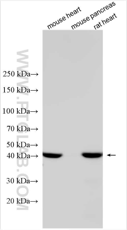 Western Blot (WB) analysis of various lysates using Alpha cardiac muscle actin specific Polyclonal ant (17522-1-AP)