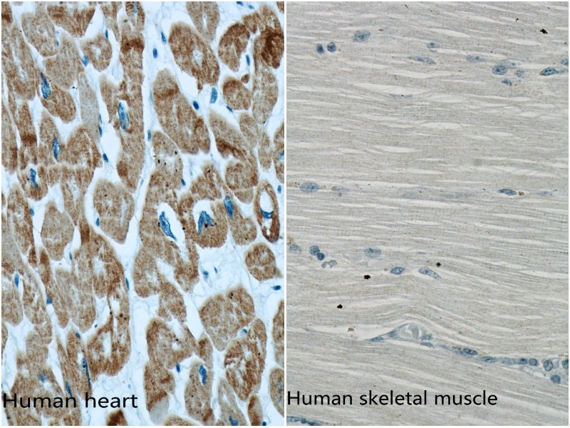 Immunohistochemistry (IHC) staining of human heart and human skeletal muscle tissue using ACTC1-specific Monoclonal antibody (66125-1-Ig)