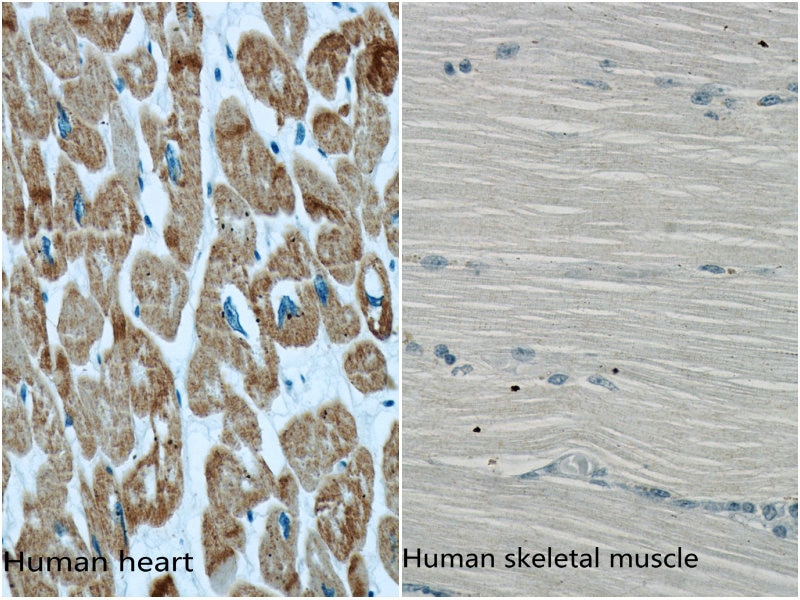 ACTC1-specific Monoclonal antibody