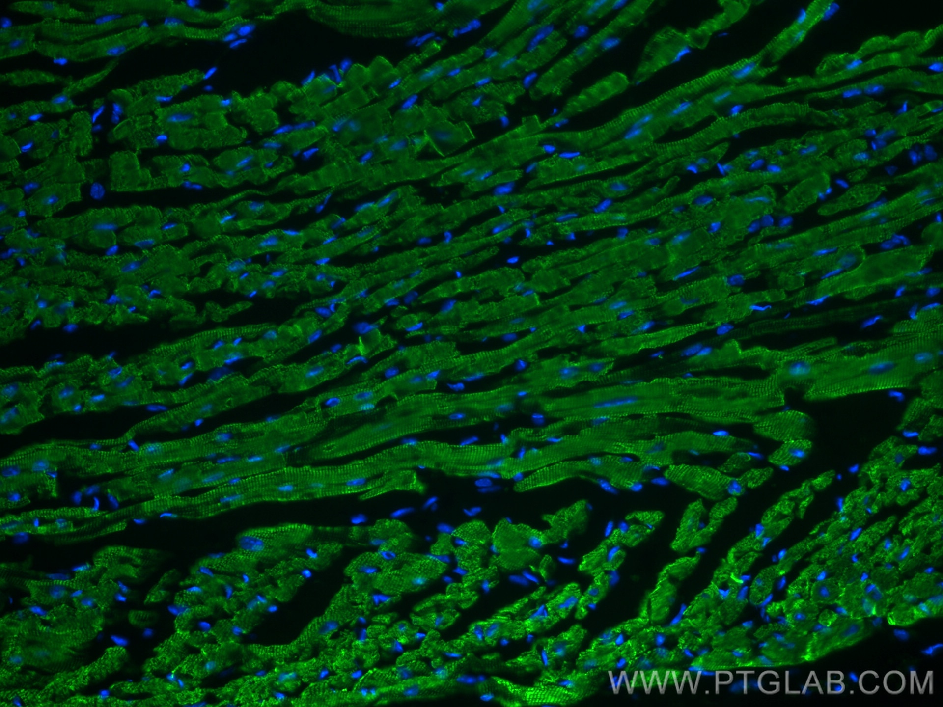 Immunofluorescence (IF) / fluorescent staining of mouse heart tissue using ACTC1-specific Monoclonal antibody (66125-1-Ig)