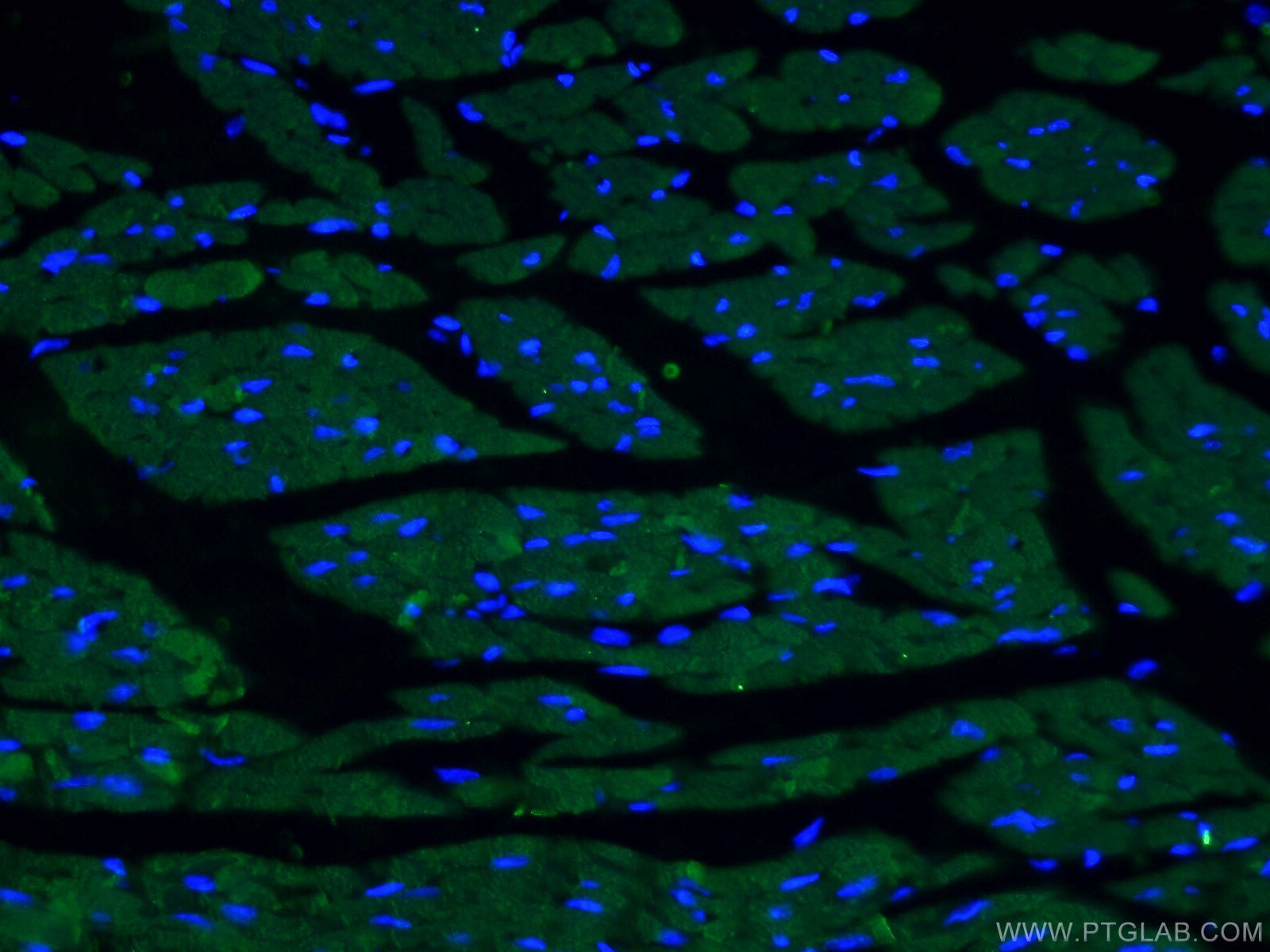 Immunofluorescence (IF) / fluorescent staining of mouse heart tissue using ACTC1-specific Monoclonal antibody (66125-1-Ig)