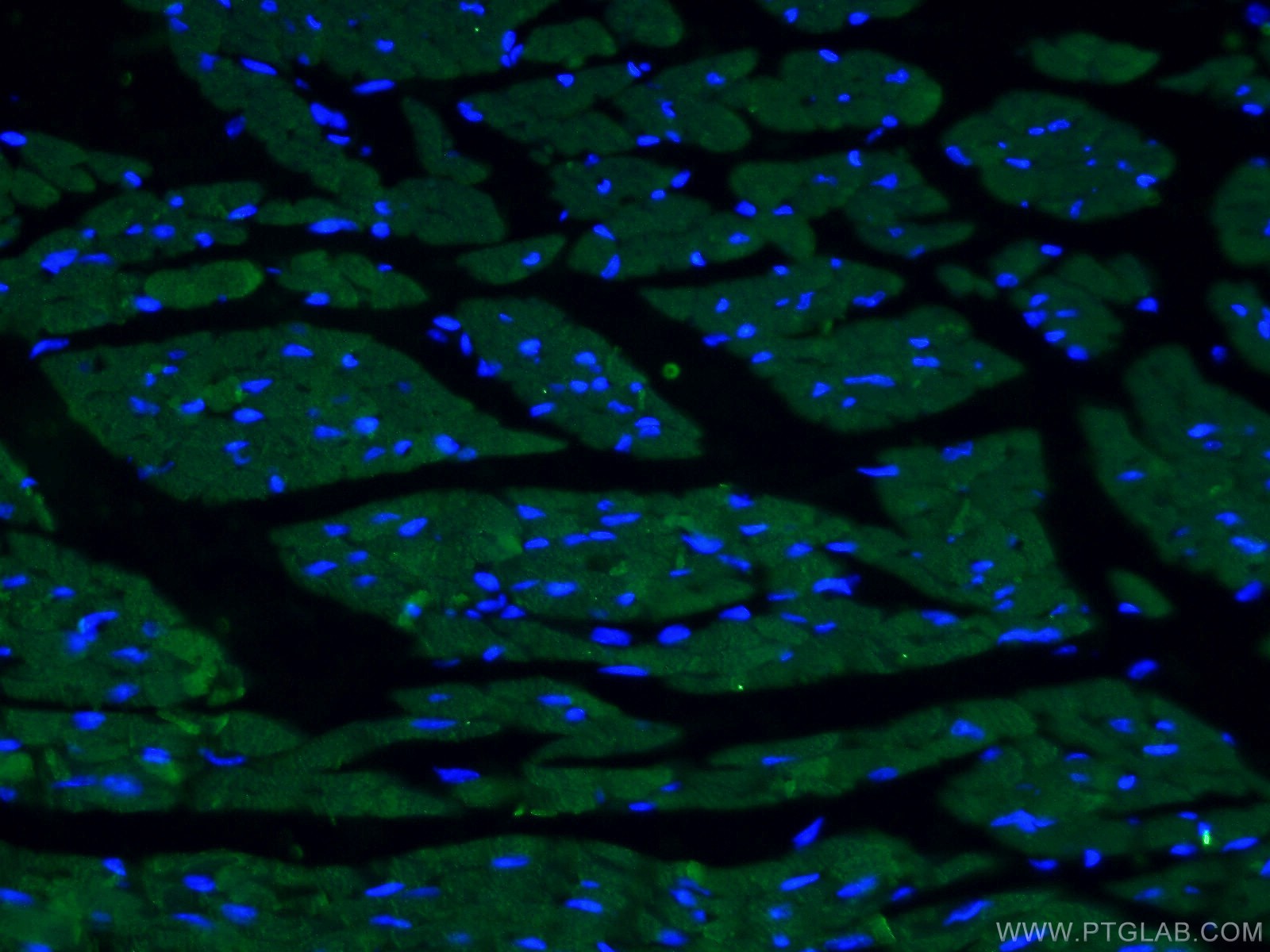 ACTC1-specific Monoclonal antibody