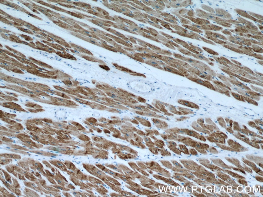 Immunohistochemistry (IHC) staining of human heart tissue using ACTC1-specific Monoclonal antibody (66125-1-Ig)