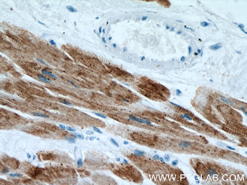 ACTC1-specific Monoclonal antibody