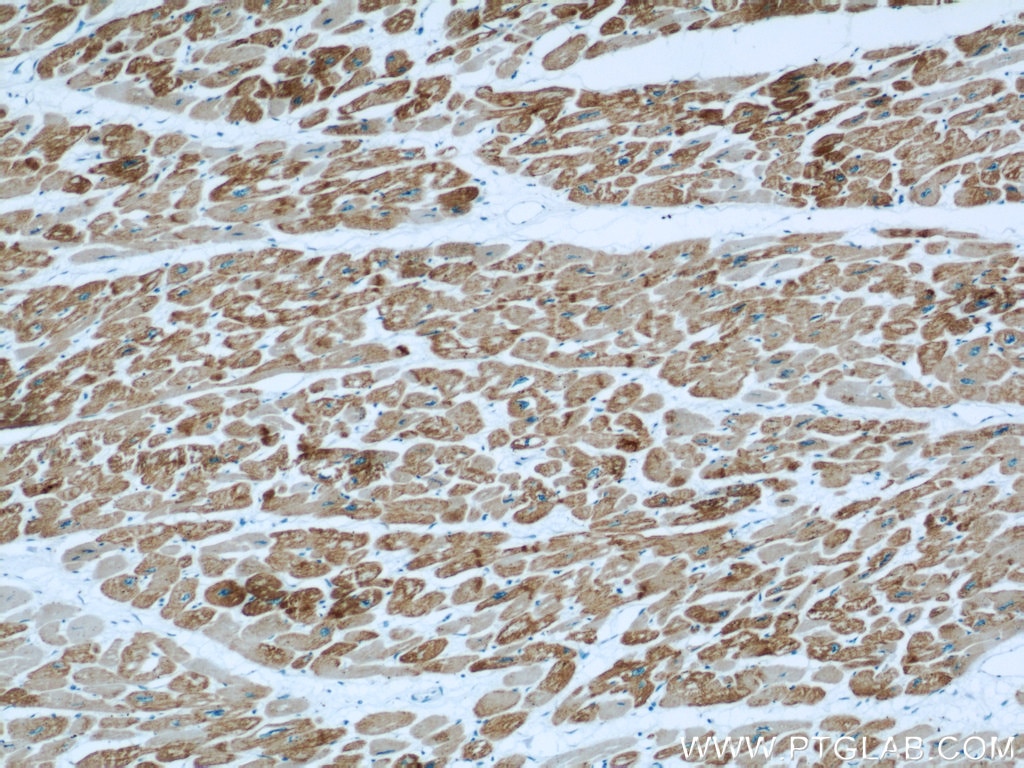 Immunohistochemistry (IHC) staining of human heart tissue using ACTC1-specific Monoclonal antibody (66125-1-Ig)