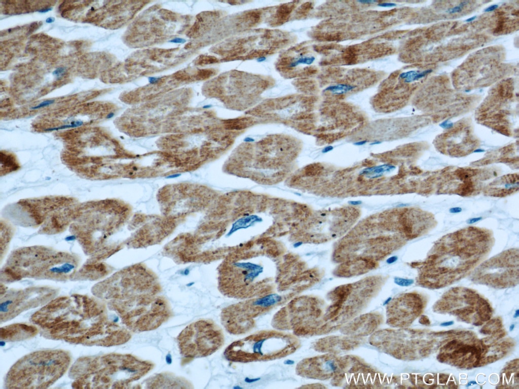 IHC staining of human heart using 66125-1-Ig