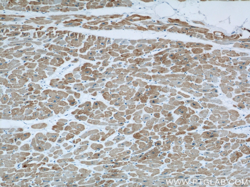 Immunohistochemistry (IHC) staining of human heart tissue using ACTC1-specific Monoclonal antibody (66125-1-Ig)