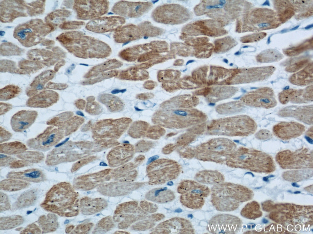 Immunohistochemistry (IHC) staining of human heart tissue using ACTC1-specific Monoclonal antibody (66125-1-Ig)