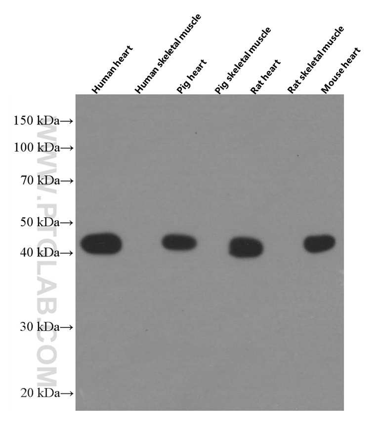 Western Blot (WB) analysis of various lysates using ACTC1-specific Monoclonal antibody (66125-1-Ig)