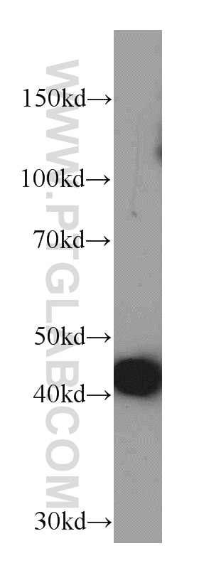 Western Blot (WB) analysis of human heart tissue using ACTC1-specific Monoclonal antibody (66125-1-Ig)