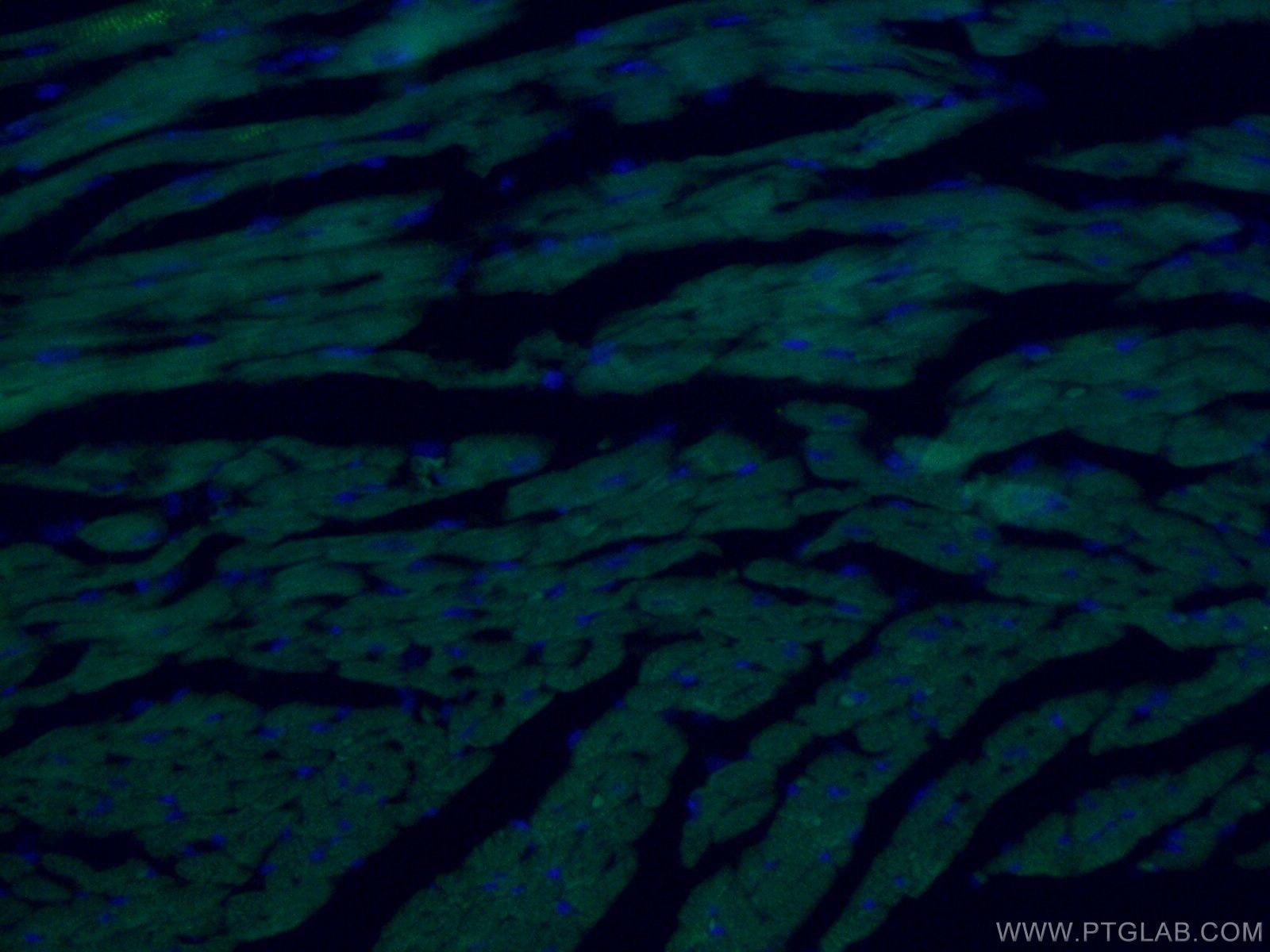 Immunofluorescence (IF) / fluorescent staining of mouse heart tissue using CoraLite® Plus 488-conjugated ACTC1-specific Monoc (CL488-66125)