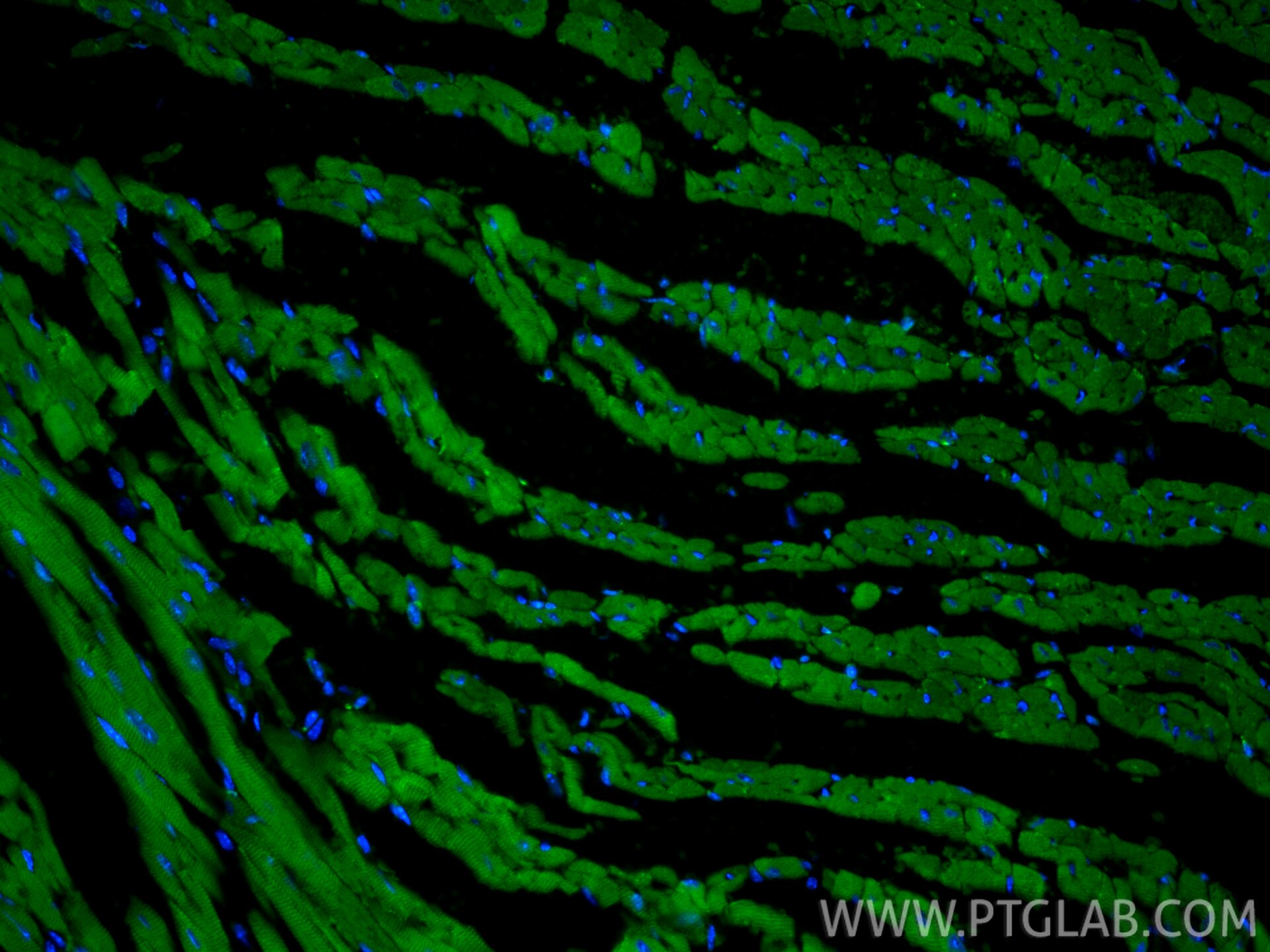 Immunofluorescence (IF) / fluorescent staining of mouse heart tissue using CoraLite® Plus 488-conjugated Alpha cardiac muscle (CL488-66125)