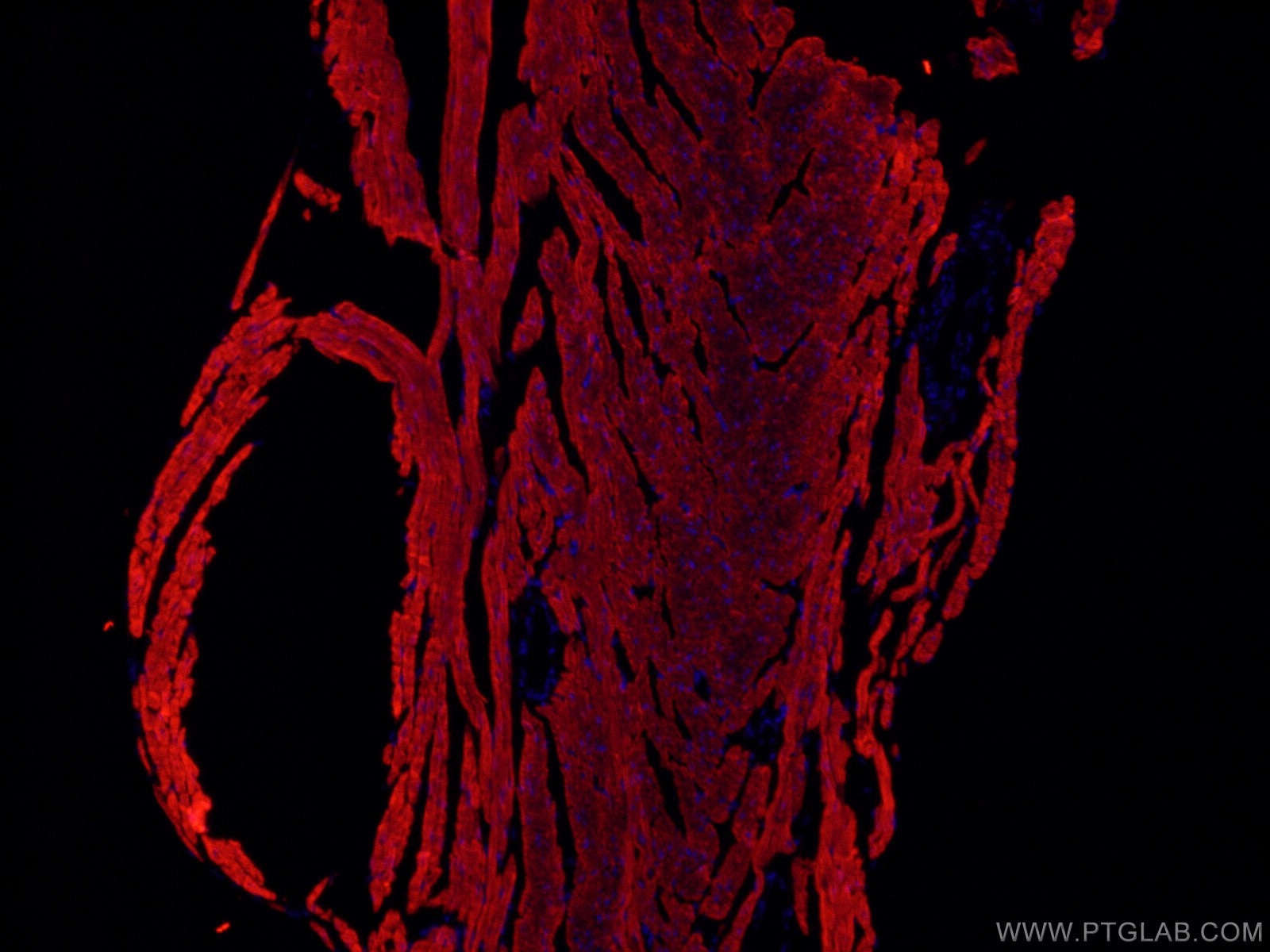 Immunofluorescence (IF) / fluorescent staining of mouse heart tissue using CoraLite®594-conjugated ACTC1-specific Monoclonal  (CL594-66125)