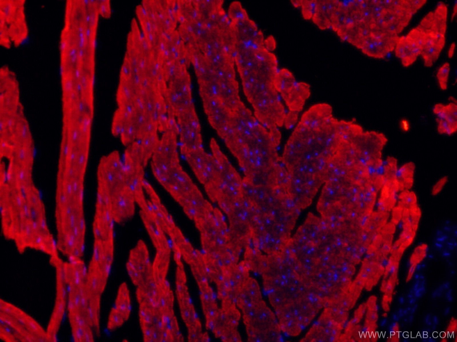 Immunofluorescence (IF) / fluorescent staining of mouse heart tissue using CoraLite®594-conjugated ACTC1-specific Monoclonal  (CL594-66125)