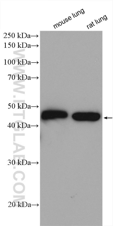 Western Blot (WB) analysis of various lysates using Gamma Actin Polyclonal antibody (11227-1-AP)