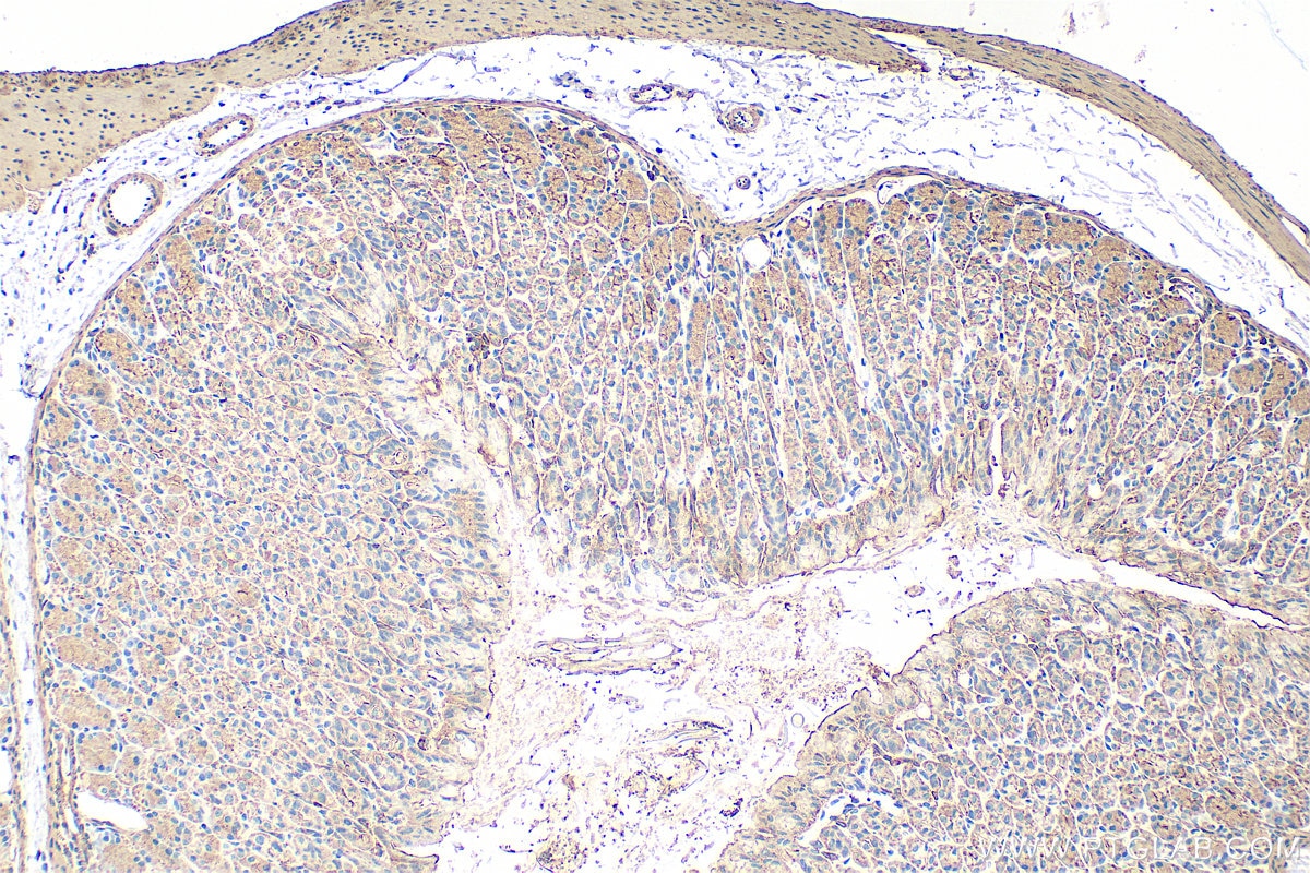 Immunohistochemistry (IHC) staining of mouse stomach tissue using ACTG2 Polyclonal antibody (31849-1-AP)