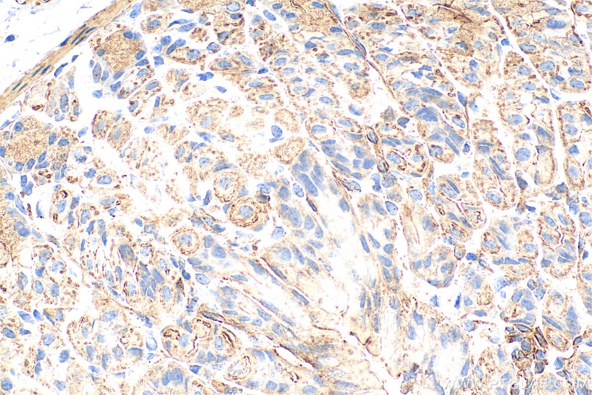 Immunohistochemistry (IHC) staining of mouse stomach tissue using ACTG2 Polyclonal antibody (31849-1-AP)