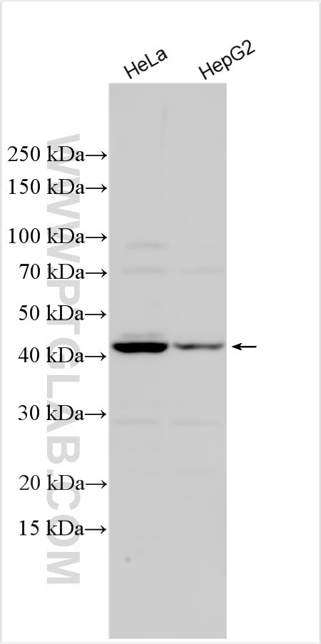 Western Blot (WB) analysis of various lysates using ACTG2 Polyclonal antibody (31849-1-AP)