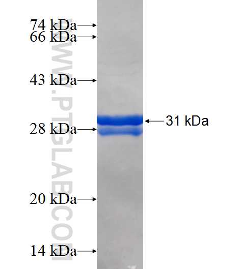 ACTL6B fusion protein Ag25745 SDS-PAGE