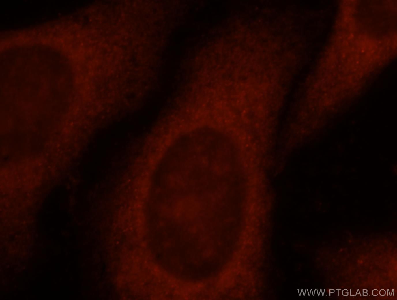 Immunofluorescence (IF) / fluorescent staining of HepG2 cells using ACTL7A Polyclonal antibody (17355-1-AP)