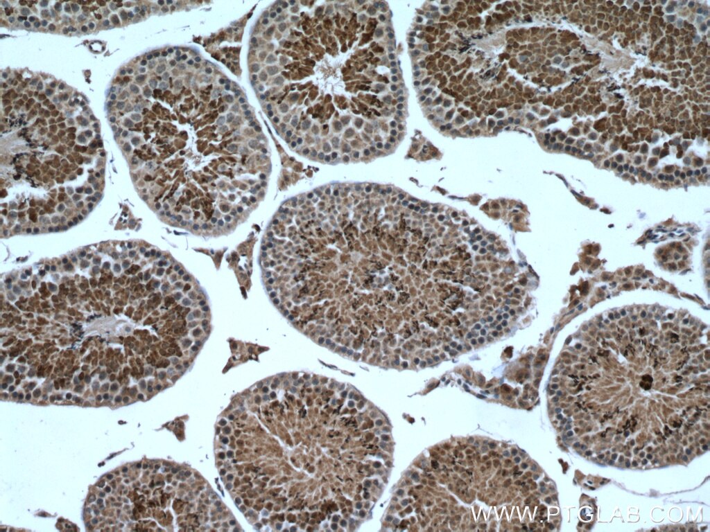 IHC staining of mouse testis using 17355-1-AP