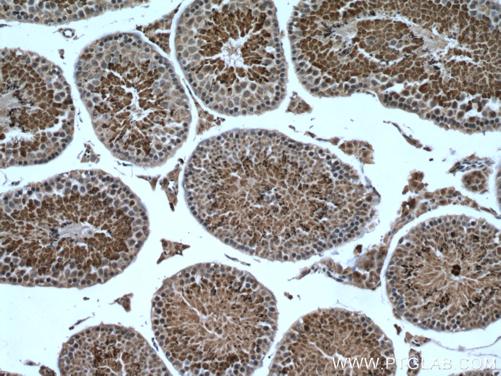 Immunohistochemistry (IHC) staining of mouse testis tissue using ACTL7A Polyclonal antibody (17355-1-AP)