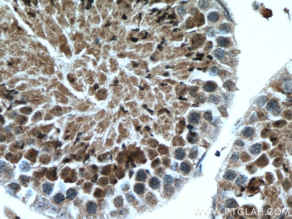 Immunohistochemistry (IHC) staining of mouse testis tissue using ACTL7A Polyclonal antibody (17355-1-AP)