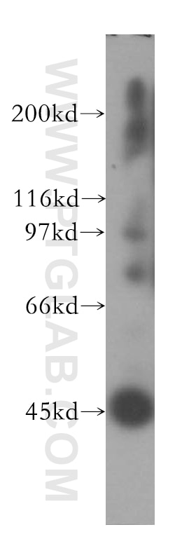 Western Blot (WB) analysis of human liver tissue using ACTL7B Polyclonal antibody (13537-1-AP)