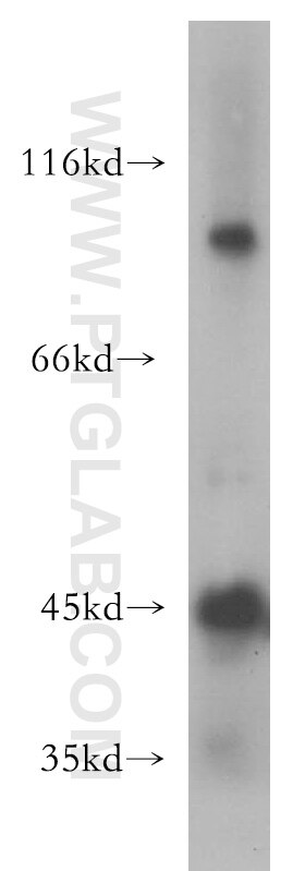 Western Blot (WB) analysis of human testis tissue using ACTL7B Polyclonal antibody (13537-1-AP)