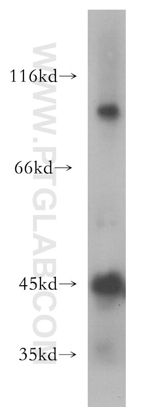 WB analysis of human testis using 13537-1-AP