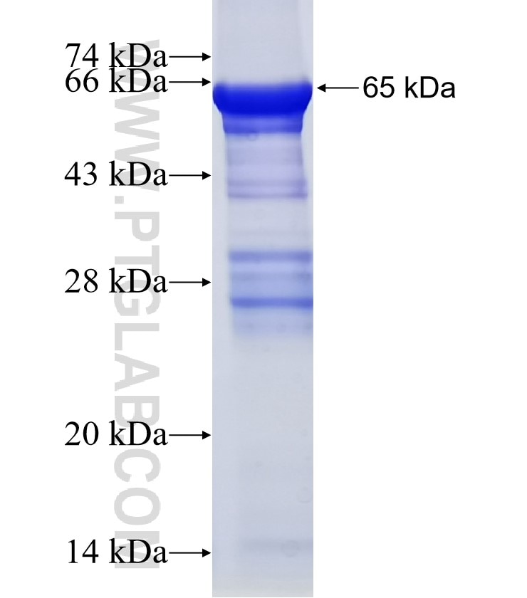 ACTL7B fusion protein Ag4460 SDS-PAGE