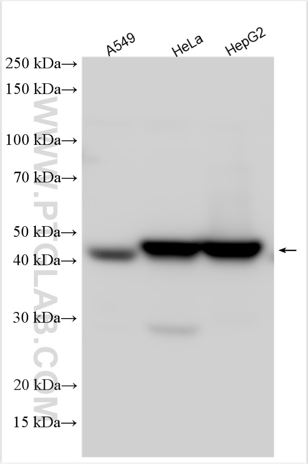 Western Blot (WB) analysis of various lysates using ACTL8 Polyclonal antibody (17312-1-AP)