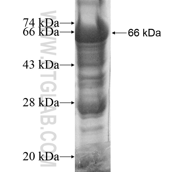 ACTL8 fusion protein Ag11281 SDS-PAGE