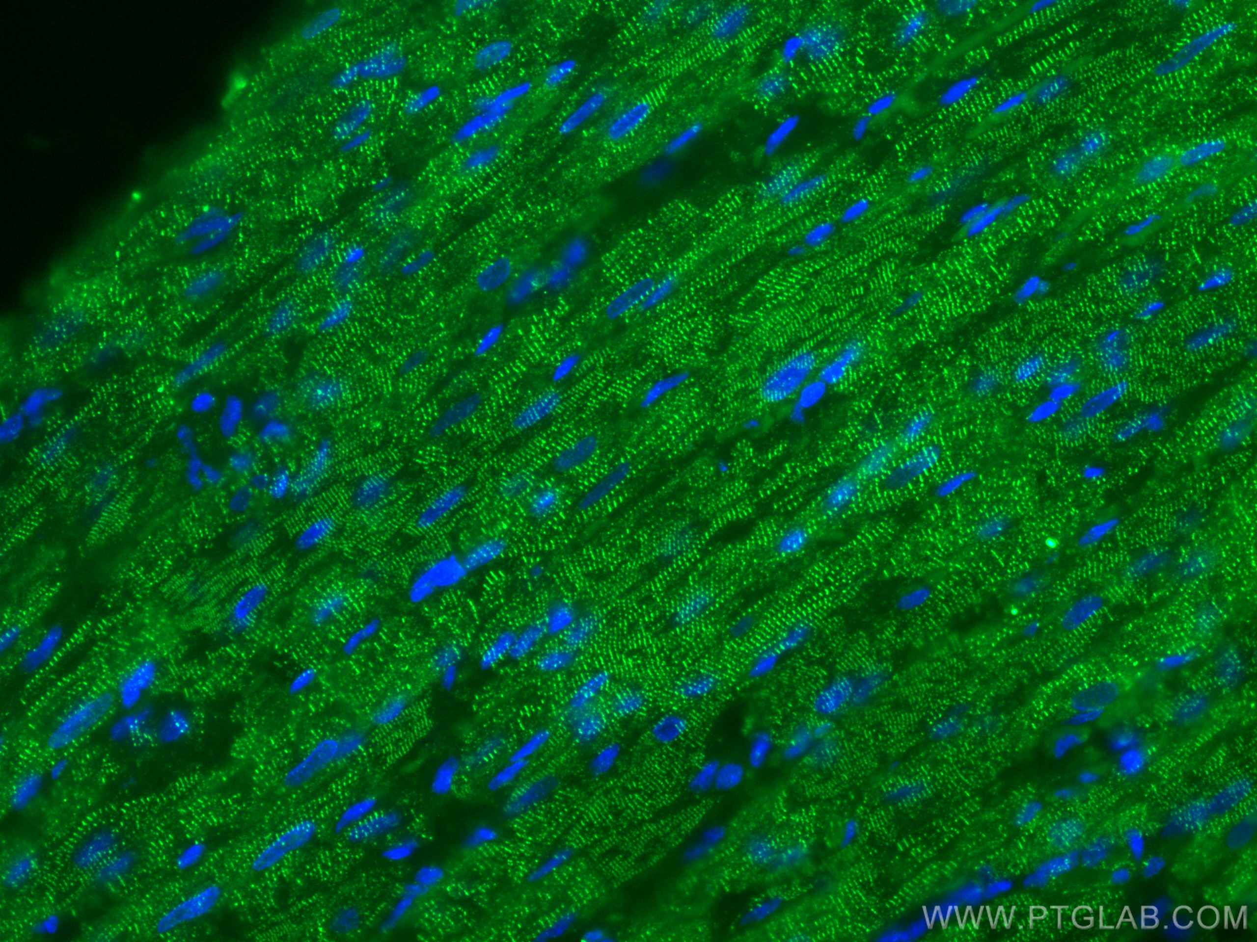 Immunofluorescence (IF) / fluorescent staining of rat heart tissue using Alpha Actinin Polyclonal antibody (11313-2-AP)