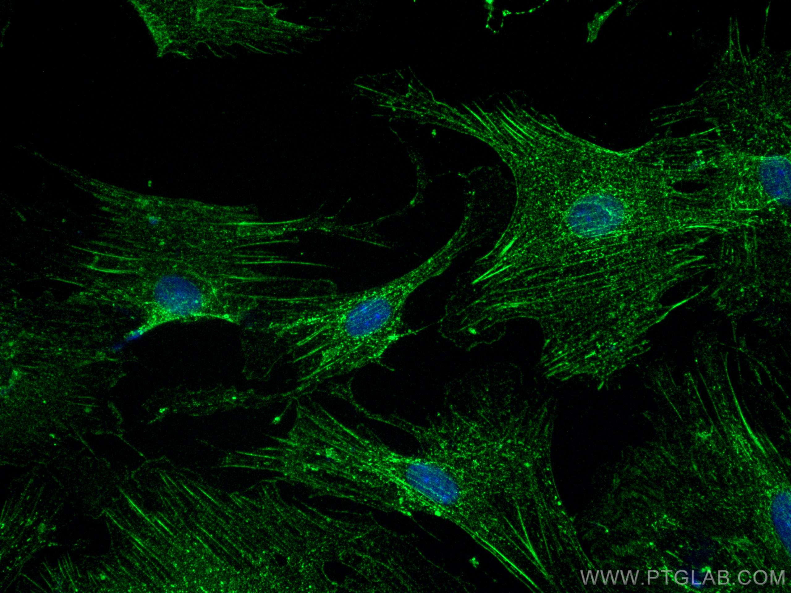 Immunofluorescence (IF) / fluorescent staining of mouse heart tissue using Alpha Actinin Polyclonal antibody (11313-2-AP)