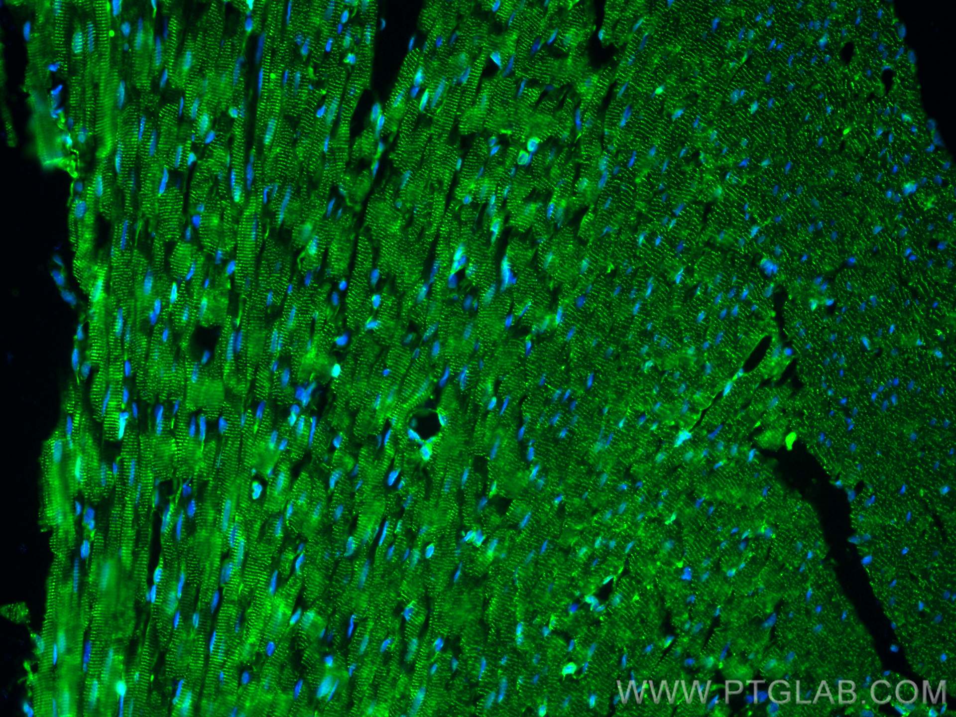 Immunofluorescence (IF) / fluorescent staining of rat heart tissue using Alpha Actinin Polyclonal antibody (11313-2-AP)