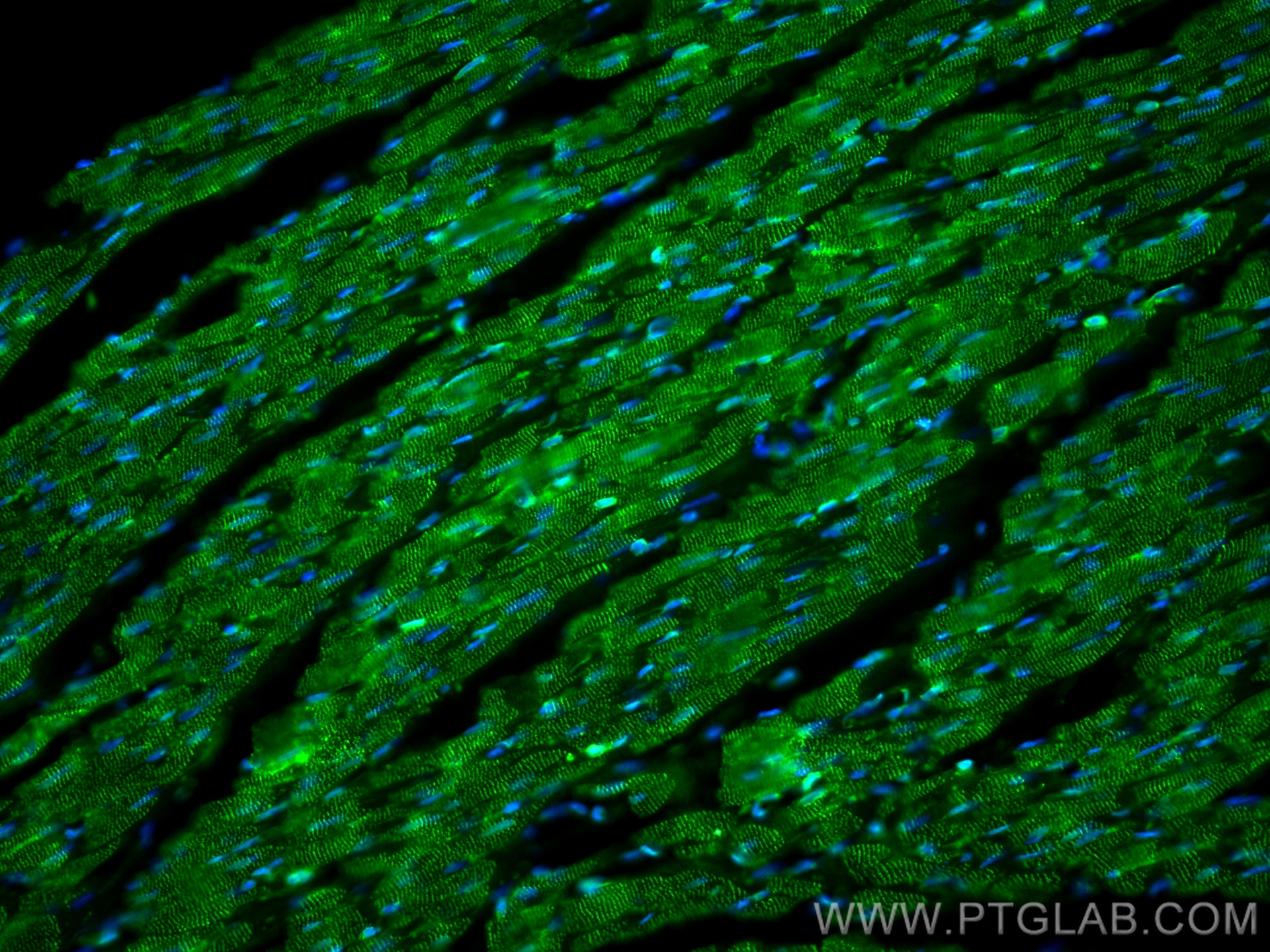 Immunofluorescence (IF) / fluorescent staining of rat heart tissue using Alpha Actinin Polyclonal antibody (11313-2-AP)