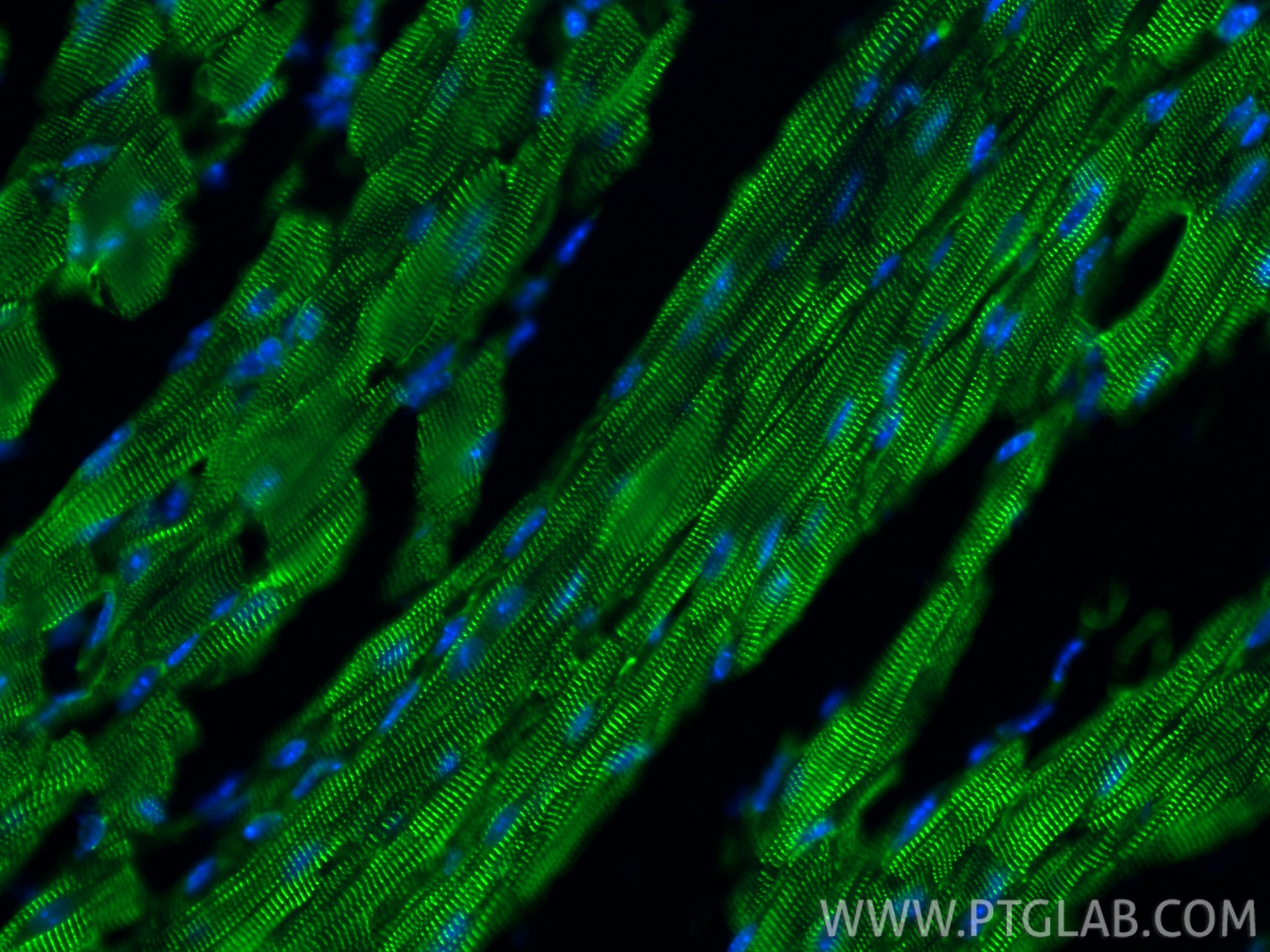 Immunofluorescence (IF) / fluorescent staining of mouse heart tissue using Alpha Actinin Polyclonal antibody (11313-2-AP)
