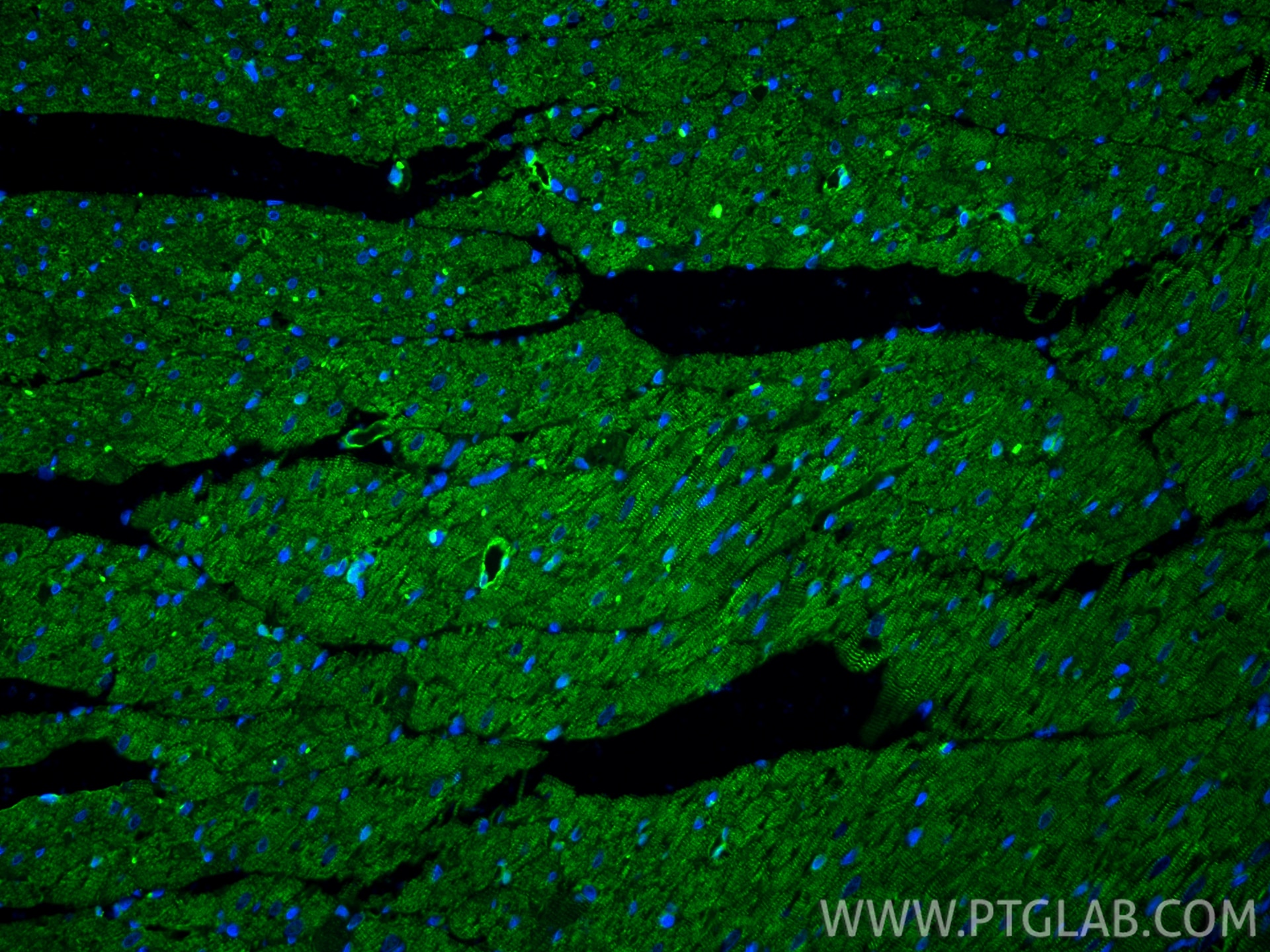Immunofluorescence (IF) / fluorescent staining of rat heart tissue using Alpha Actinin Polyclonal antibody (11313-2-AP)