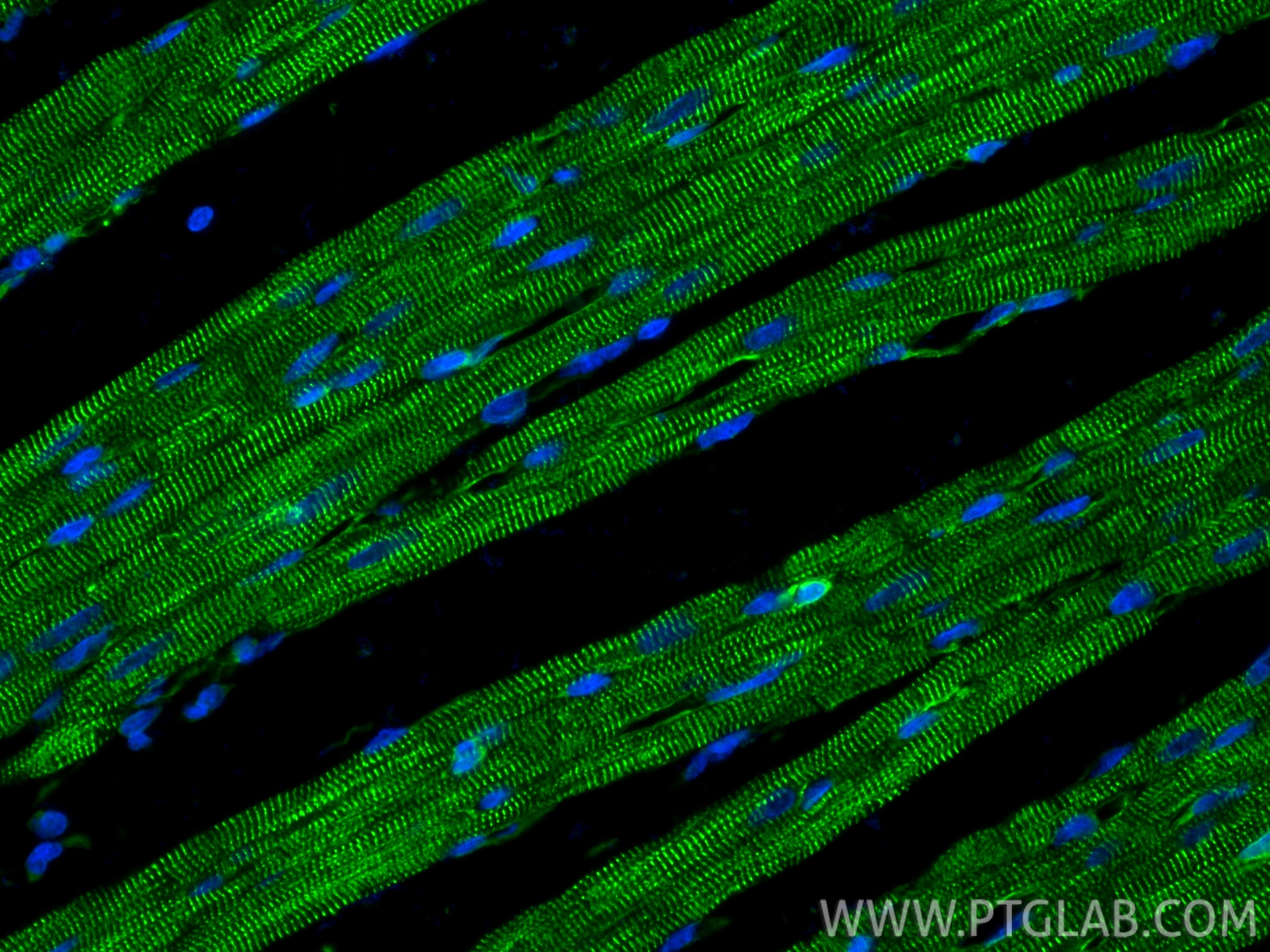 Immunofluorescence (IF) / fluorescent staining of rat heart tissue using Alpha Actinin Polyclonal antibody (11313-2-AP)
