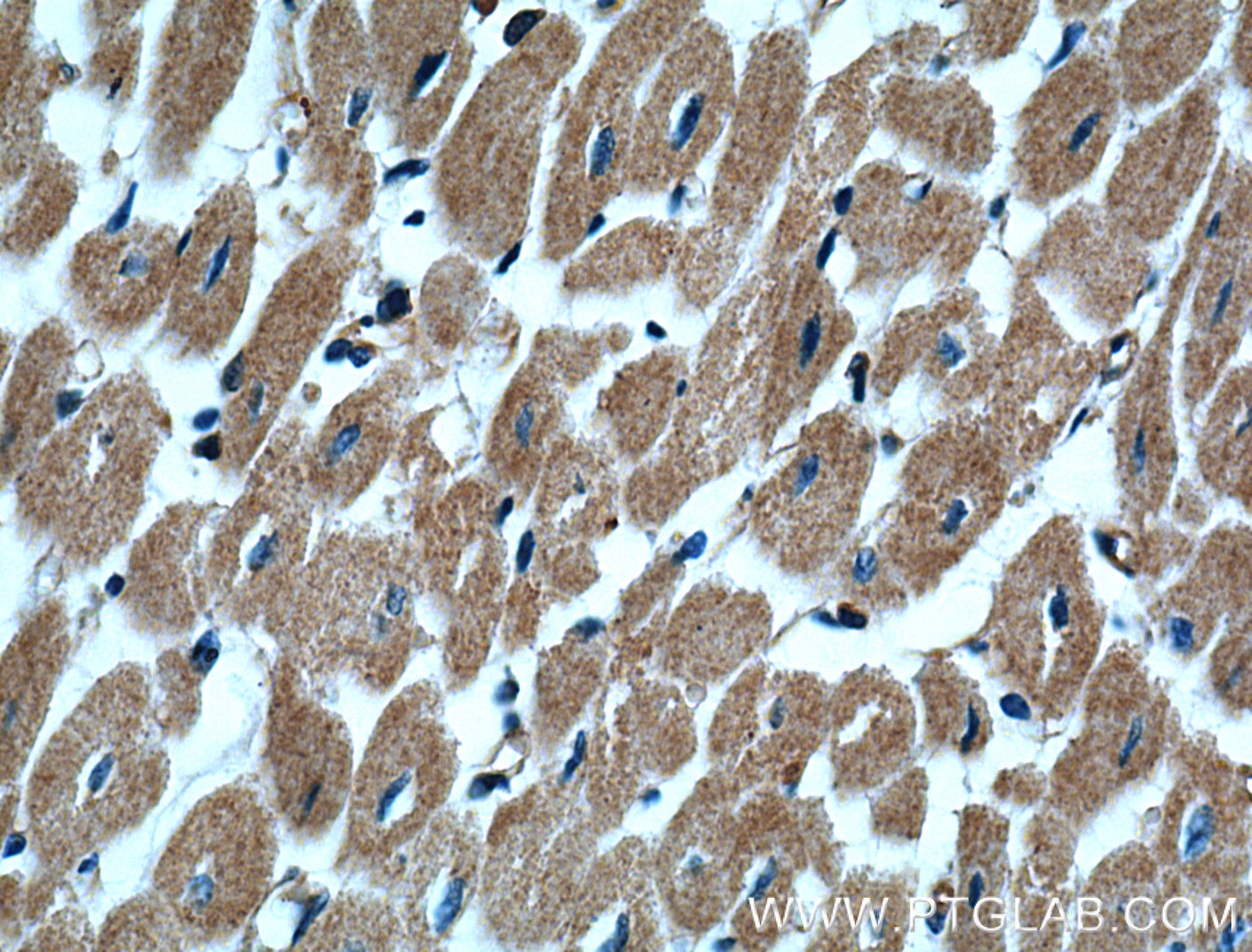 Immunohistochemistry (IHC) staining of human heart tissue using Alpha Actinin Polyclonal antibody (11313-2-AP)