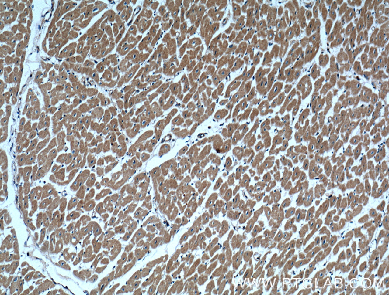 IHC staining of human heart using 11313-2-AP